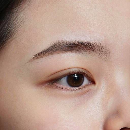 Macro Shot of Down Syndrome Eyebrows