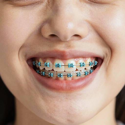 Cheerful Close-Up Smiling Teeth Braces